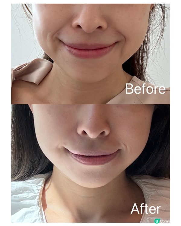 備婚日記Jovena FaceStim深層面肌運動療程分享