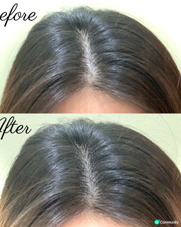 頭髮都要照燈 💡無痛居家生髮科技♦️