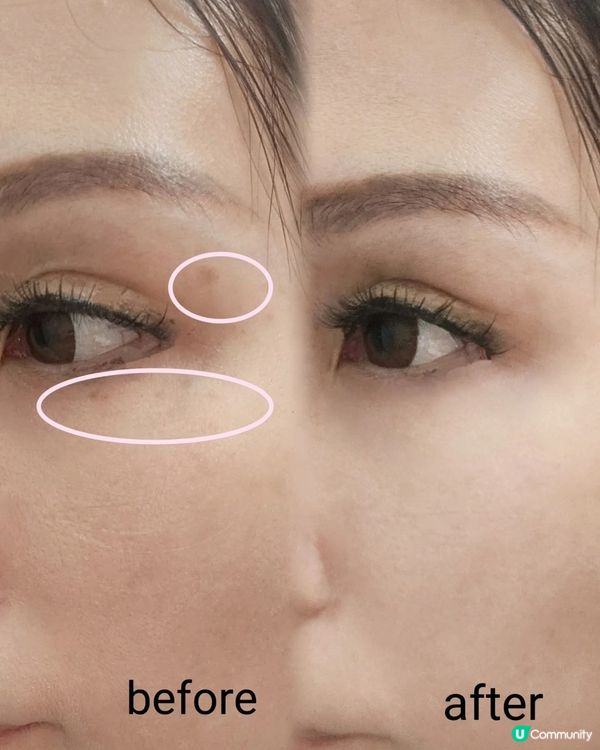 【超光炮美容儀】買一送六！🔥 14日透亮牛奶肌！🥛