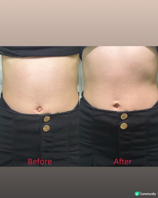 便秘救星！🇯🇵 好速纖消腩丸幫你減腩！🔥 萬寧優惠！