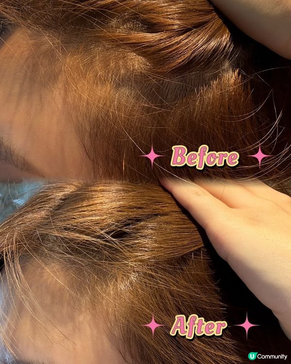 究極濃生髮丸！頭髮濃密靠晒佢💪🏻✨
