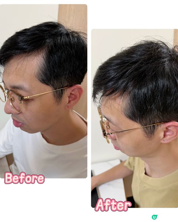 【 頭髮濃密的秘密武器 】