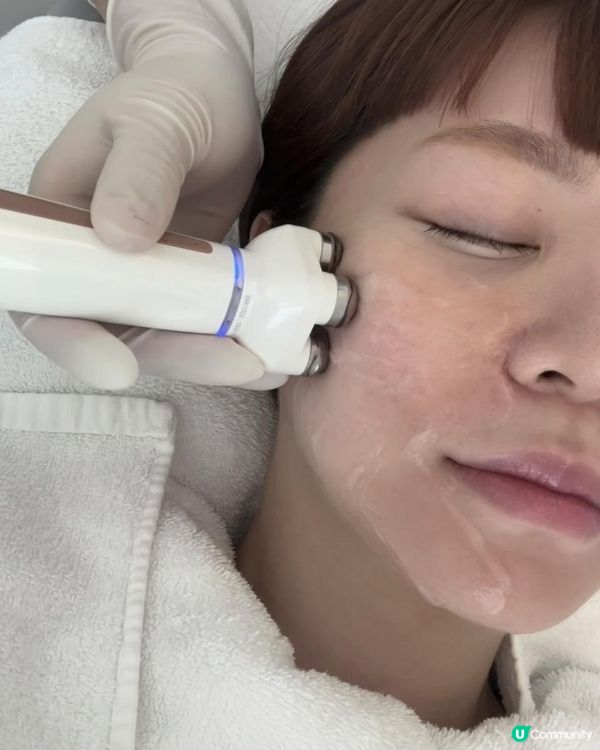 +medispa 意大利 Jovena FaceStim®️ 「面部普拉提」驚喜體驗！即時輪廓UP UP 30+ 必試