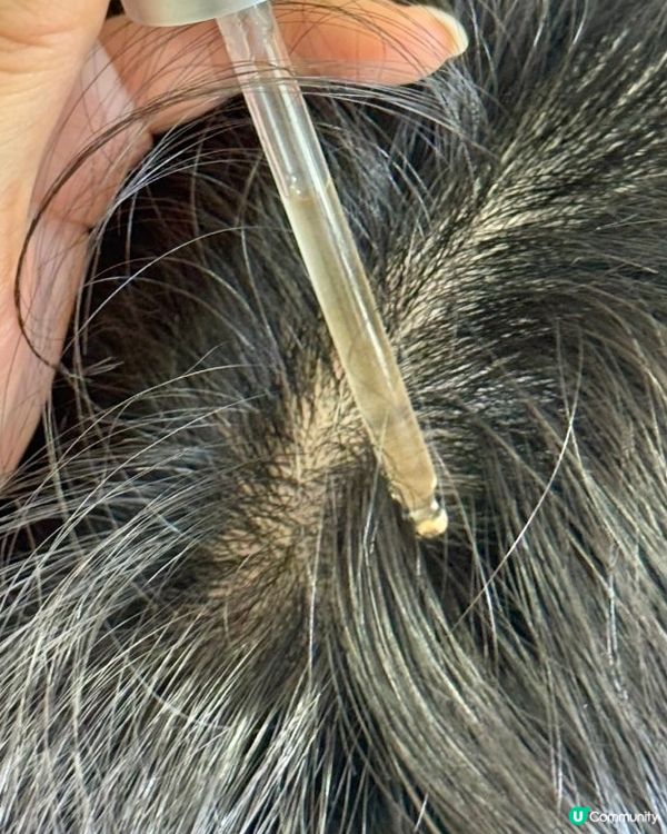 🇰🇷韓國OliveYoung好物分享‼️脫髮精華實測‼️油頭救星💯