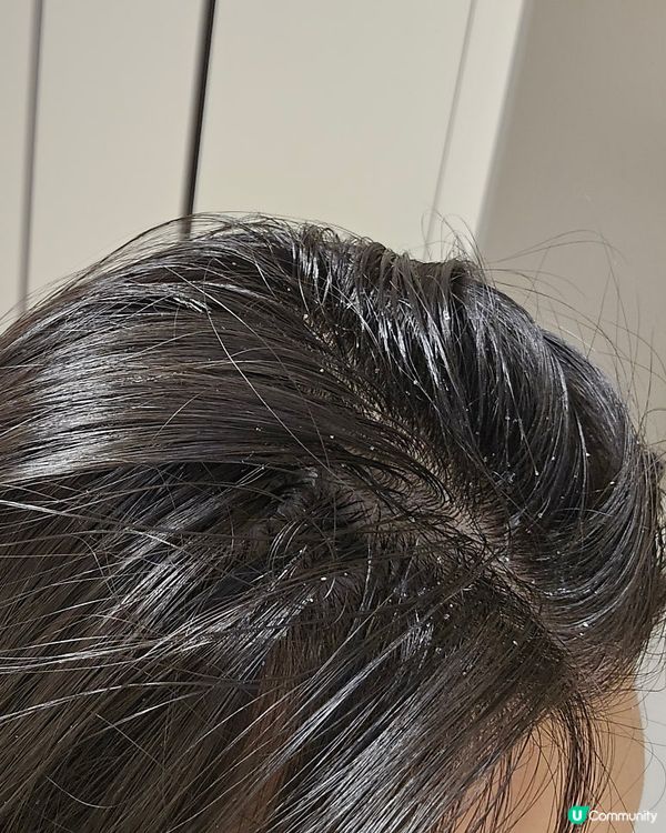 【實測】🇰🇷韓國Daiso紅參防脫髮5件套‼️KO頭皮問題‼️