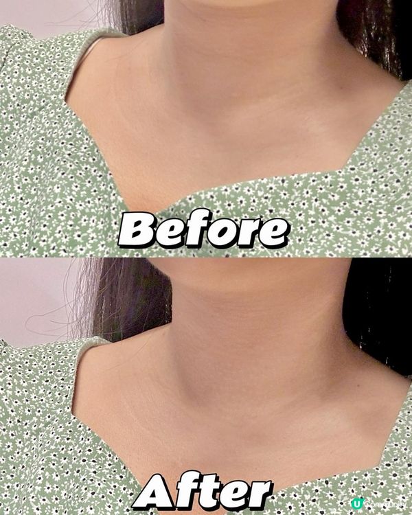 🌻Sllight x 「A醛逆齡袪紋頸膜」+「腹部溶脂緊緻貼片」✨