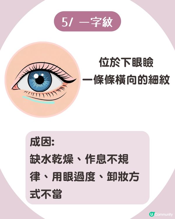 告別眼紋！6大類型深度解析 5大成因/預防策略👁️魚尾紋/細紋有得救！