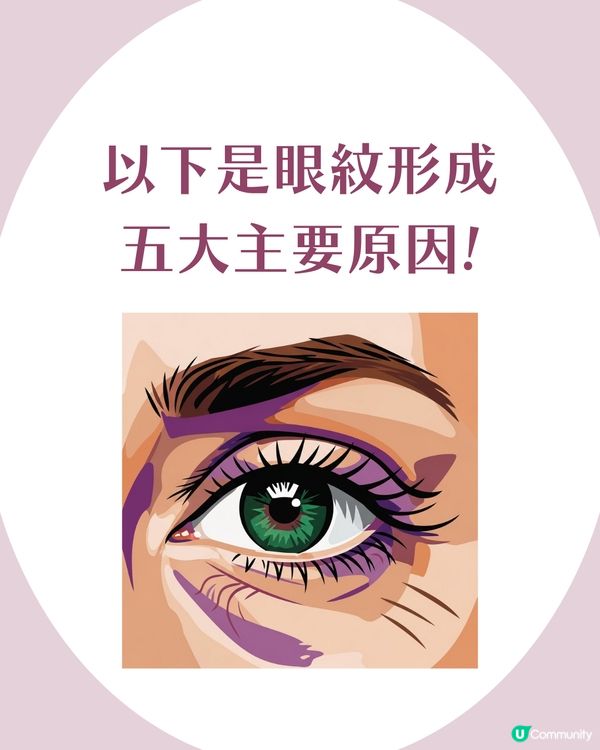 告別眼紋！6大類型深度解析 5大成因/預防策略👁️魚尾紋/細紋有得救！