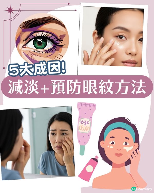 告別眼紋！6大類型深度解析 5大成因/預防策略👁️魚尾紋/細紋有得救！