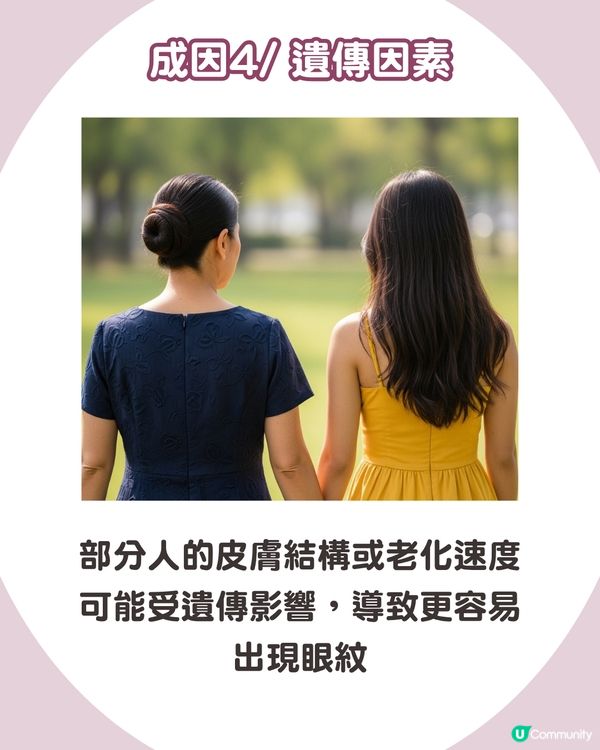 告別眼紋！6大類型深度解析 5大成因/預防策略👁️魚尾紋/細紋有得救！