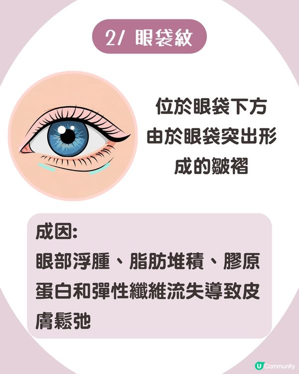 告別眼紋！6大類型深度解析 5大成因/預防策略👁️魚尾紋/細紋有得救！