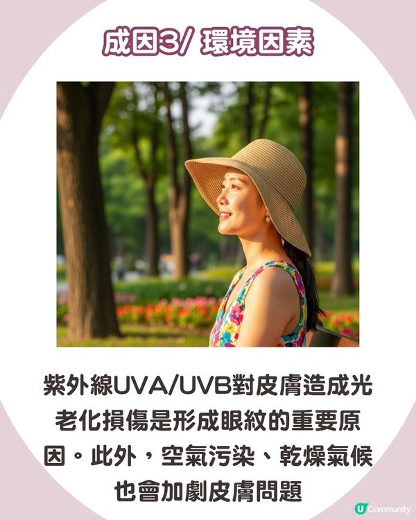 告別眼紋！6大類型深度解析 5大成因/預防策略👁️魚尾紋/細紋有得救！