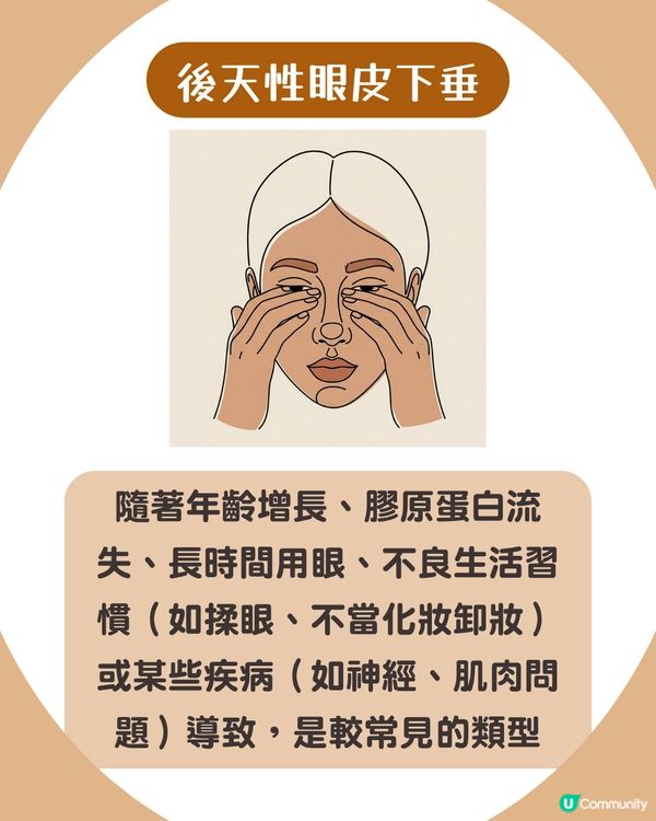 告別疲態！眼皮下垂5大原因解析+7招改善眼周肌膚鬆弛