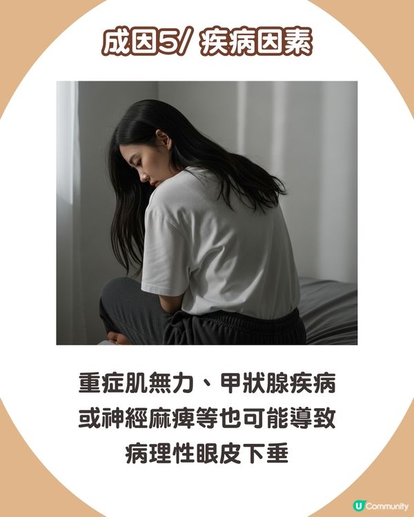 告別疲態！眼皮下垂5大原因解析+7招改善眼周肌膚鬆弛