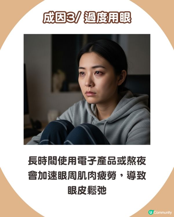 告別疲態！眼皮下垂5大原因解析+7招改善眼周肌膚鬆弛