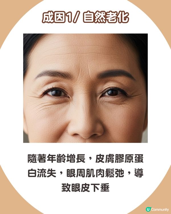 告別疲態！眼皮下垂5大原因解析+7招改善眼周肌膚鬆弛