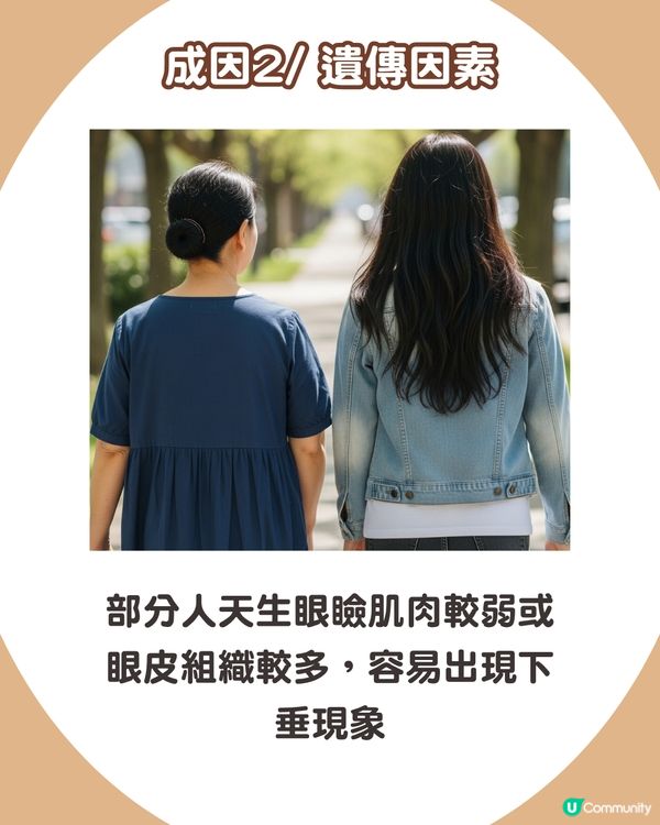 告別疲態！眼皮下垂5大原因解析+7招改善眼周肌膚鬆弛