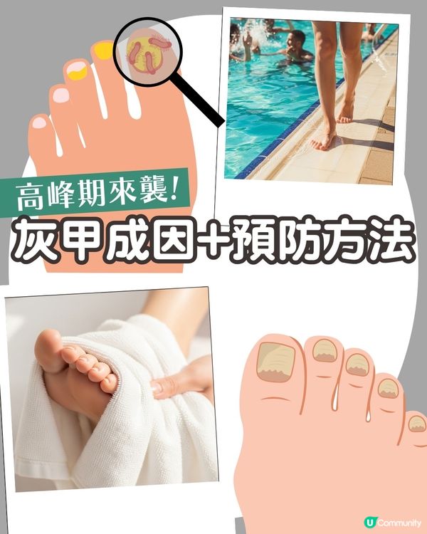 炎夏=灰甲高峰期來襲🦠3類人士易感染+6大預防方法