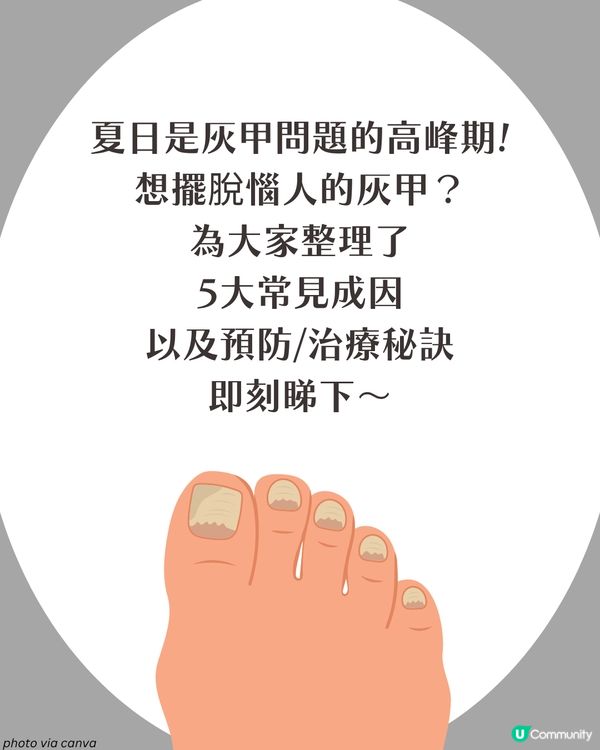 炎夏=灰甲高峰期來襲🦠3類人士易感染+6大預防方法