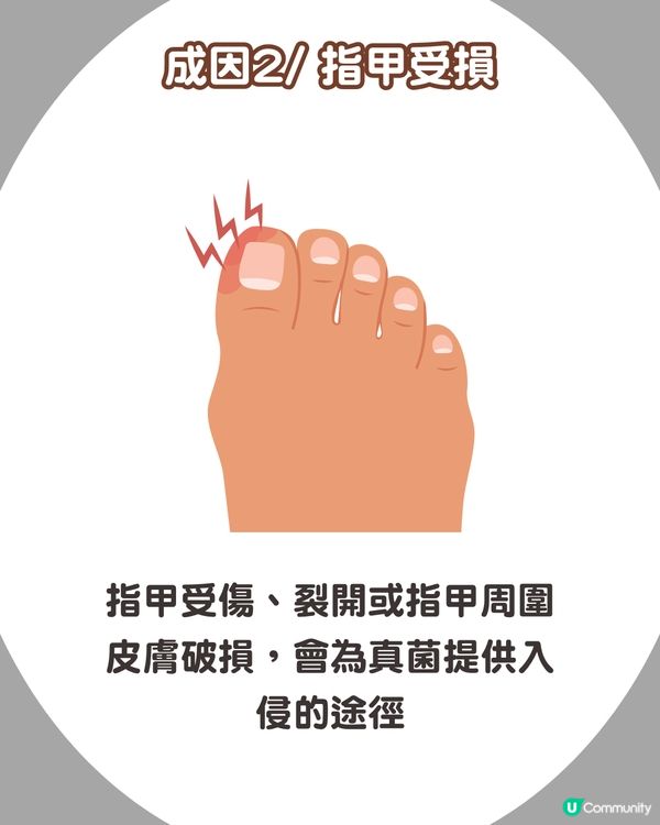 炎夏=灰甲高峰期來襲🦠3類人士易感染+6大預防方法