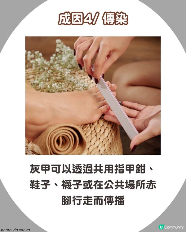 炎夏=灰甲高峰期來襲🦠3類人士易感染+6大預防方法