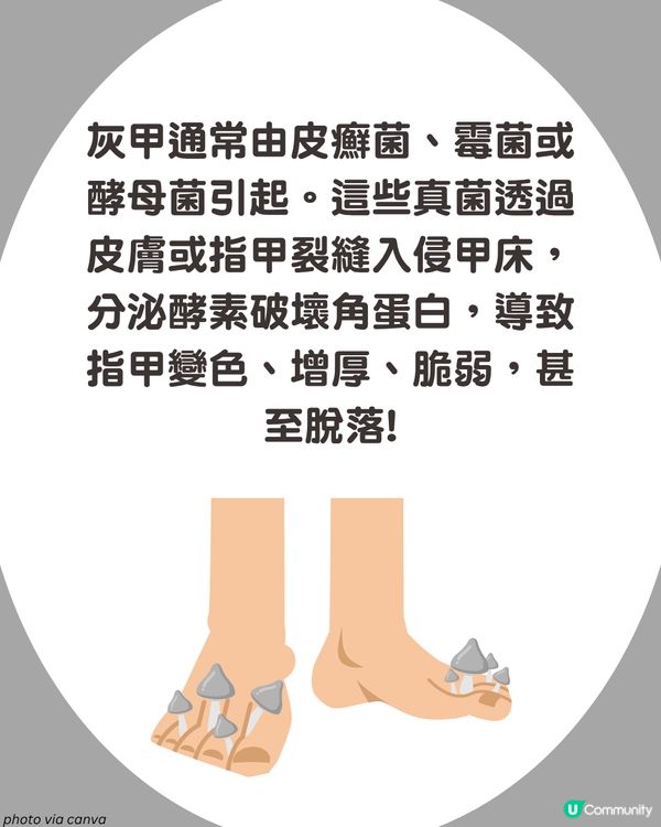 炎夏=灰甲高峰期來襲🦠3類人士易感染+6大預防方法