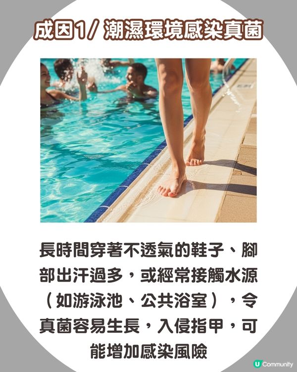 炎夏=灰甲高峰期來襲🦠3類人士易感染+6大預防方法