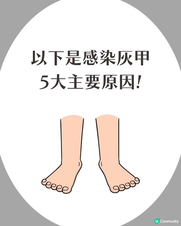 炎夏=灰甲高峰期來襲🦠3類人士易感染+6大預防方法