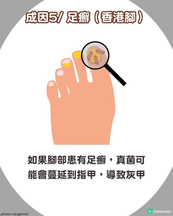 炎夏=灰甲高峰期來襲🦠3類人士易感染+6大預防方法