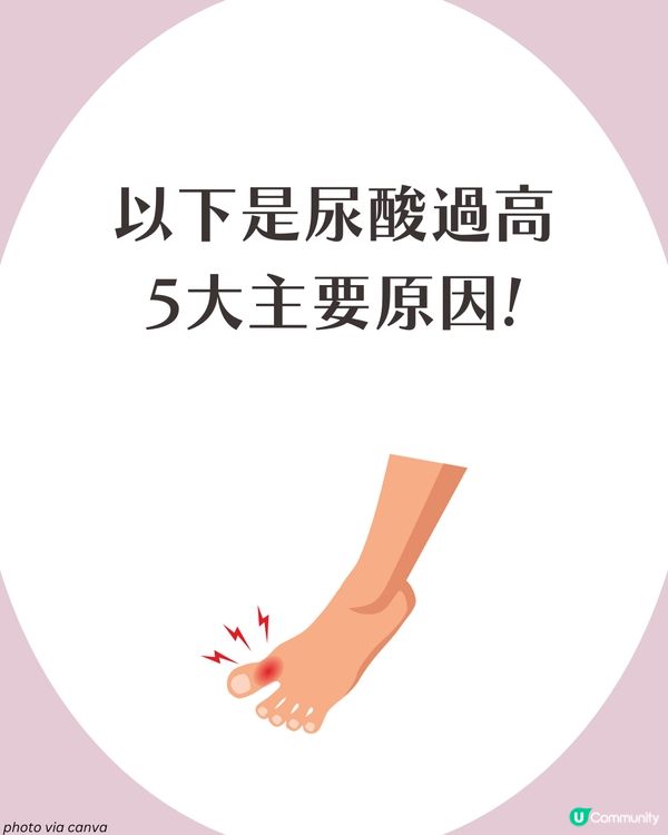 痛風全攻略：了解尿酸過高根源💢 5大痛風成因、症狀與預防