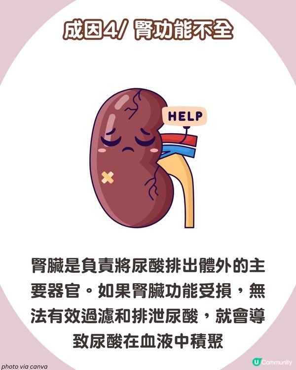 痛風全攻略：了解尿酸過高根源💢 5大痛風成因、症狀與預防