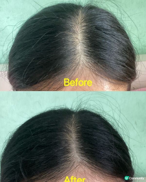 脫髮救星！草本健髮飲幫到你 🤩 