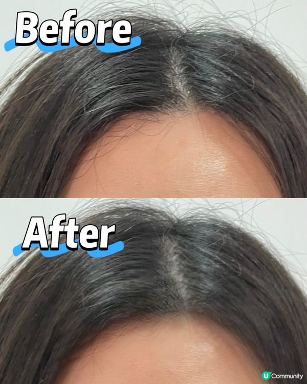 髮線危機🚨？健發密密飲救星！😎 3盒起包郵！