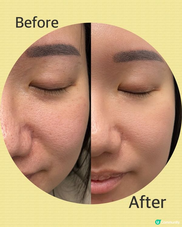 最近見到呢支Cellmaxium急救橄欖白藜蘆醇精華,聽聞連...