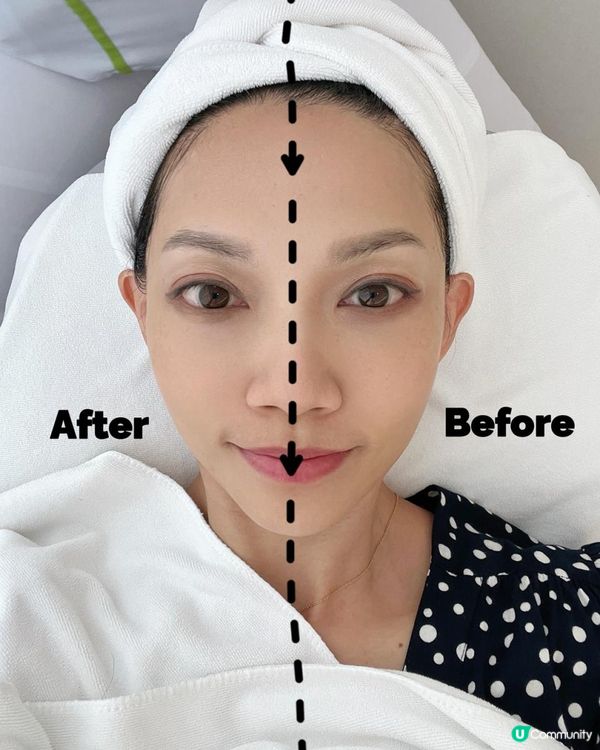 小顏原是夢！實測Jovena FaceStim®「面部普拉提」