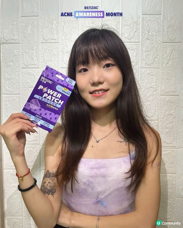 重要日子爆痘？救星嚟啦！🤩 3重功效痘痘貼7折！🔥