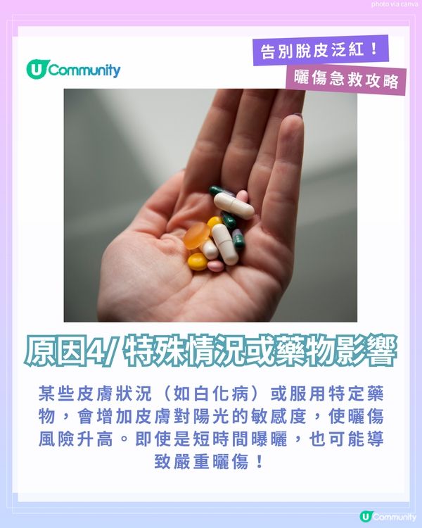 曬傷點算?☀️ 6大後續處理方法+禁做4件事！ 教你告別脫皮泛紅！