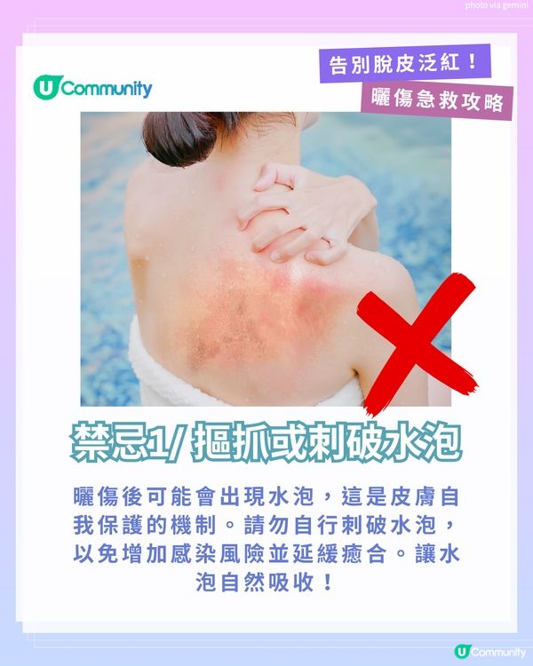 曬傷點算?☀️ 6大後續處理方法+禁做4件事！ 教你告別脫皮泛紅！
