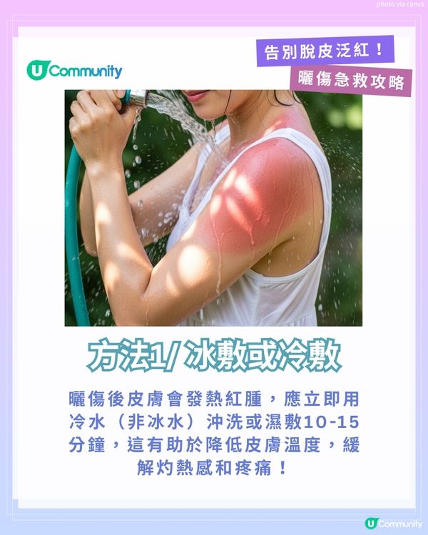 曬傷點算?☀️ 6大後續處理方法+禁做4件事！ 教你告別脫皮泛紅！