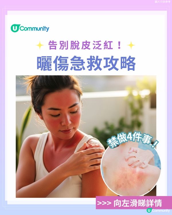 曬傷點算?☀️ 6大後續處理方法+禁做4件事！ 教你告別脫皮泛紅！