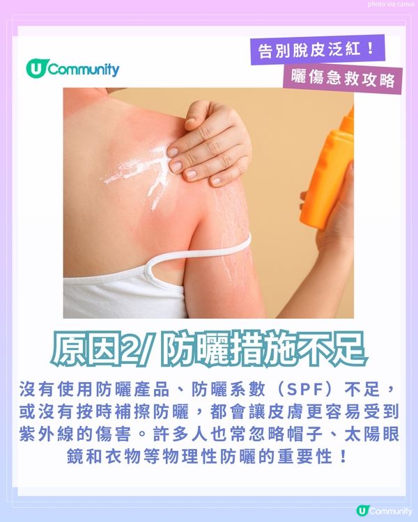 曬傷點算?☀️ 6大後續處理方法+禁做4件事！ 教你告別脫皮泛紅！