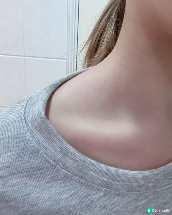 😭頸疣走開！疣凍寧幫到你✨ 