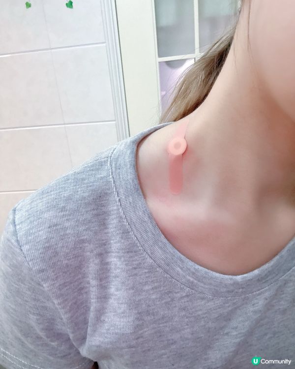 😭頸疣走開！疣凍寧幫到你✨ 