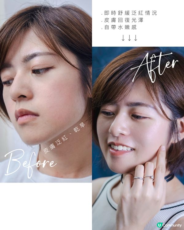/ 明星大推急救精華📸✨ /