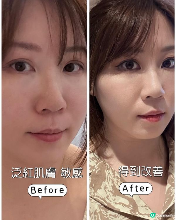 Cellmaxium 急救橄欖白藜蘆醇精華，能迅速褪紅💕、鎮靜舒緩