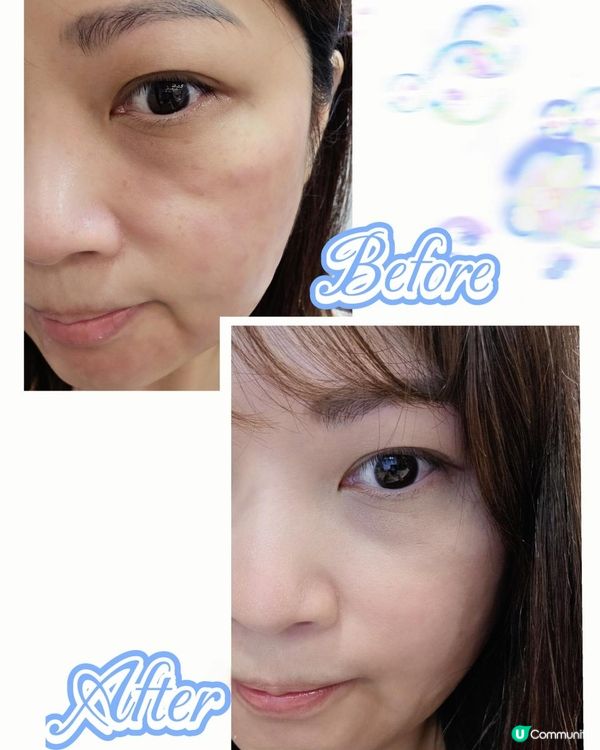 🤍Keep住珍珠肌！LAETIGEN®珠珠針緊緻肌膚淡斑亮白老實測分享✨