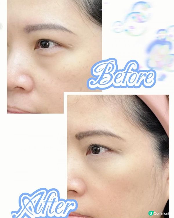 🤍Keep住珍珠肌！LAETIGEN®珠珠針緊緻肌膚淡斑亮白老實測分享✨