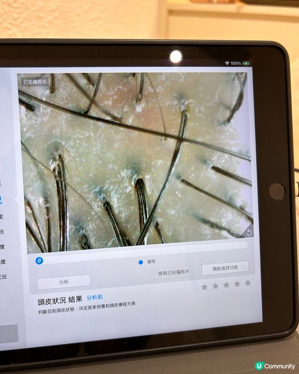 Hairs髮夢生髮中心