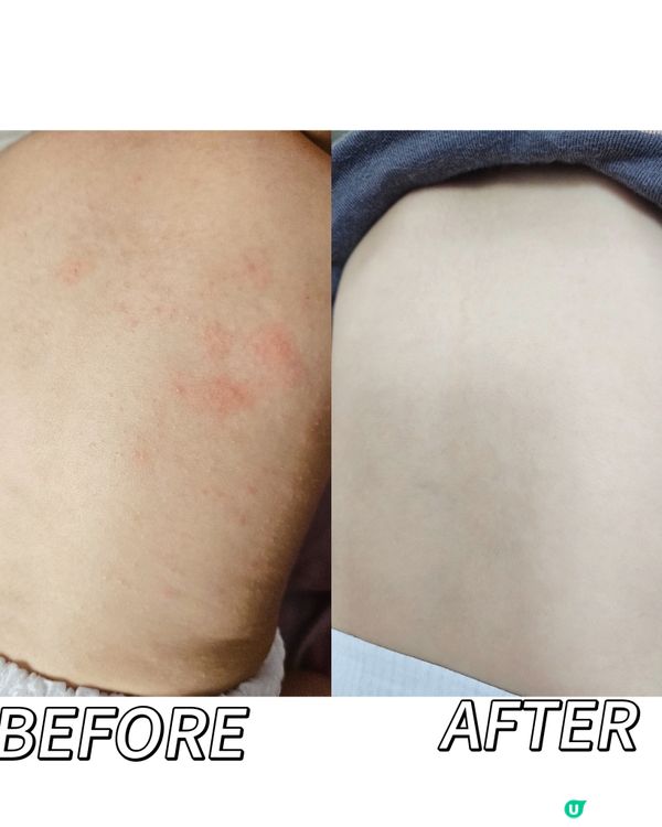 無懼寵物致敏•防敏奶粉