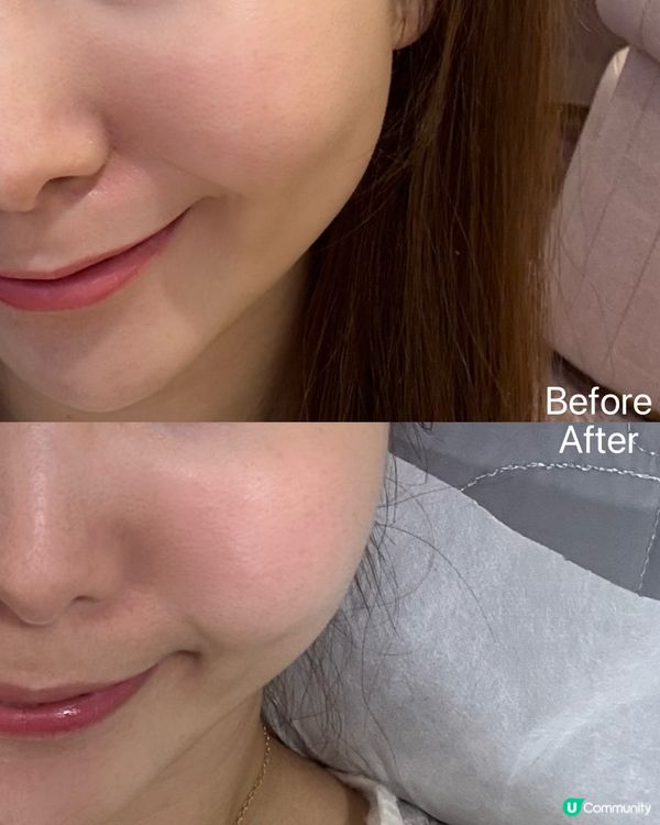 褪紅急救精華！告別敏感肌👋🏻✨